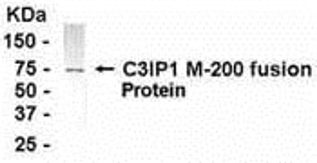 E coli-derived fusion protein as test antigen. Affi-pure IgY dilution: 1:2000, Goat anti-IgY-HRP dilution: 1:1000. Colorimetric method for signal development.