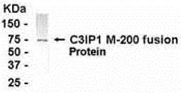 E coli-derived fusion protein as test antigen. Affi-pure IgY dilution: 1:2000, Goat anti-IgY-HRP dilution: 1:1000. Colorimetric method for signal development.