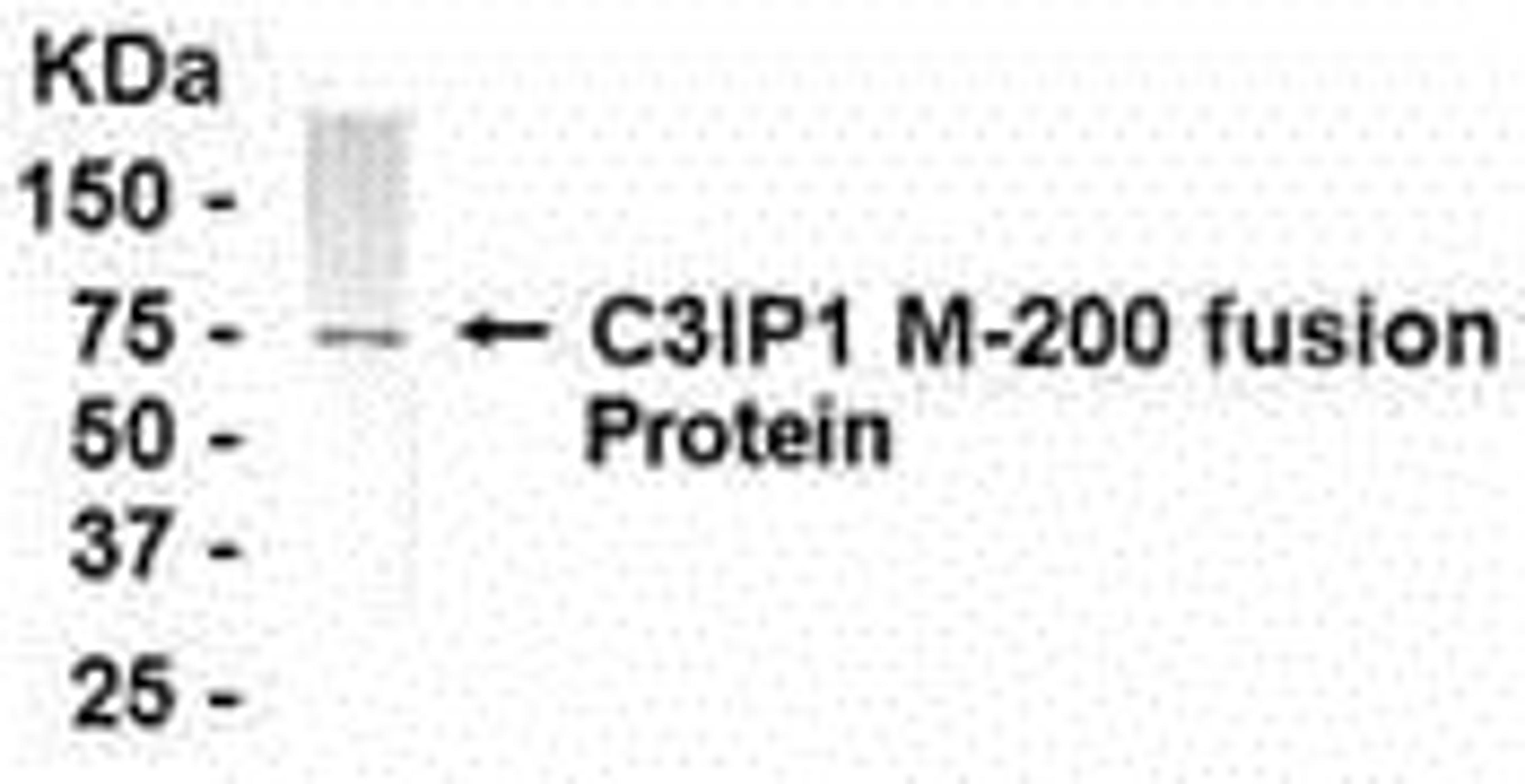 E coli-derived fusion protein as test antigen. Affi-pure IgY dilution: 1:2000, Goat anti-IgY-HRP dilution: 1:1000. Colorimetric method for signal development.