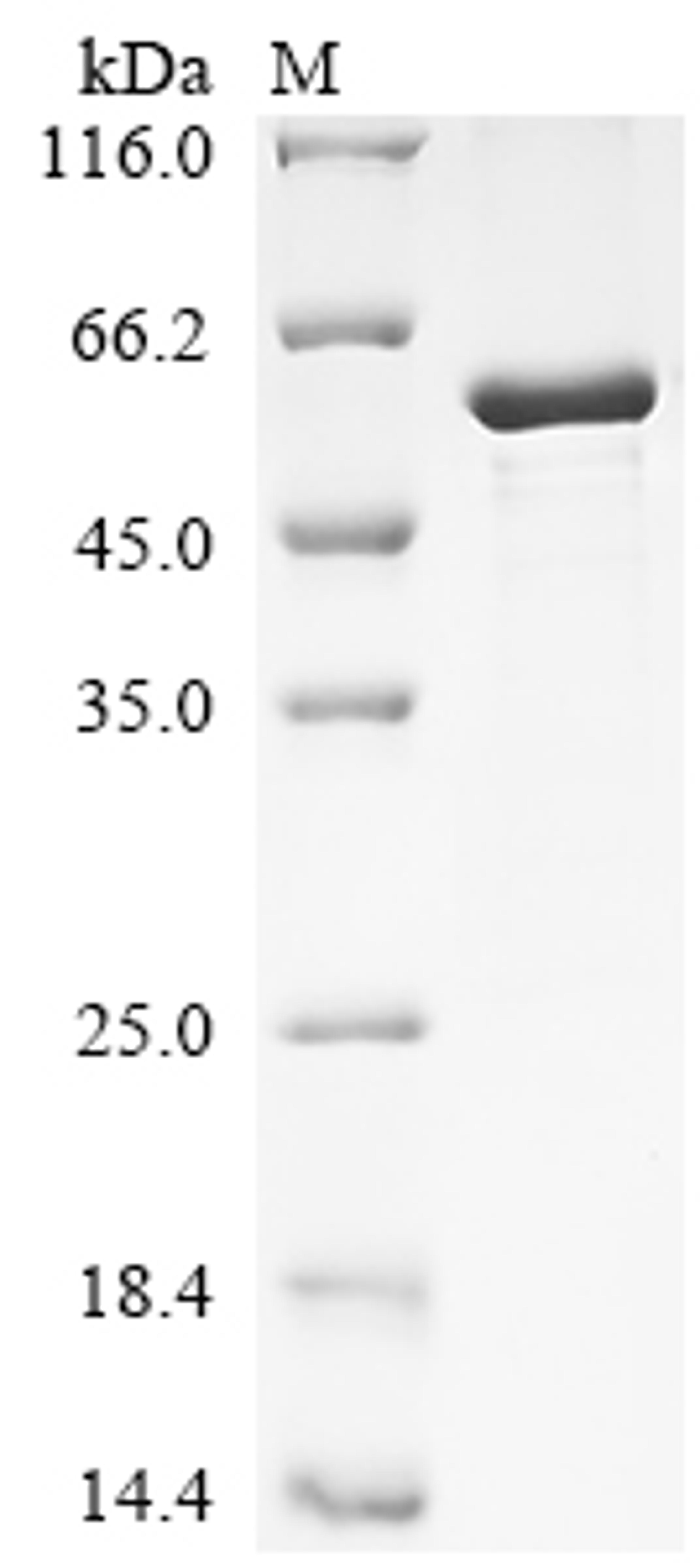 (Tris-Glycine gel) Discontinuous SDS-PAGE (reduced) with 5% enrichment gel and 15% separation gel.