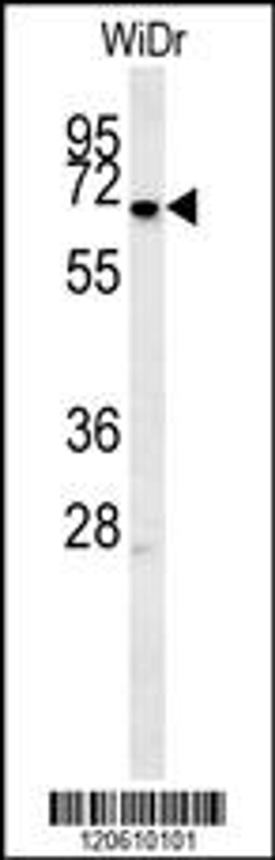 Western blot analysis in WiDr cell line lysates (15ug/lane).This demonstrates the MEIS2 antibody detected the MEIS2 protein (arrow).