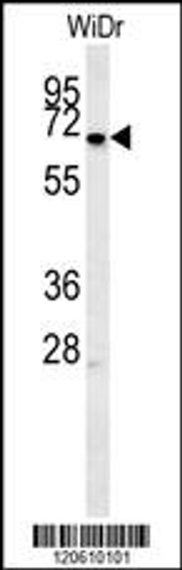 Western blot analysis in WiDr cell line lysates (15ug/lane).This demonstrates the MEIS2 antibody detected the MEIS2 protein (arrow).