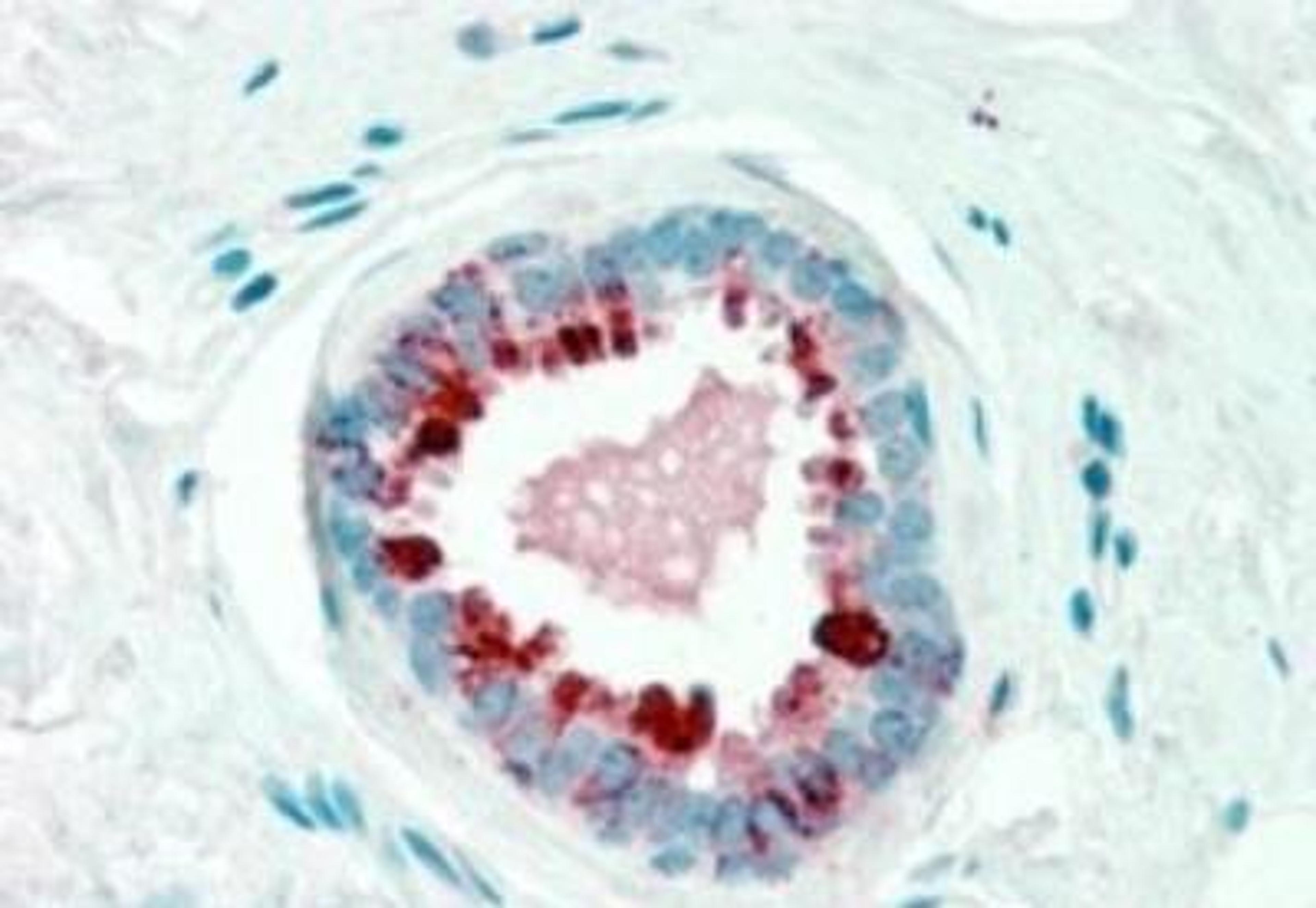 Immunohistochemistry-Paraffin: PIP Antibody [NB100-2923] - (2.5ug/ml) staining of paraffin embedded Human Breast. Steamed antigen retrieval with citrate buffer pH 6, AP-staining.