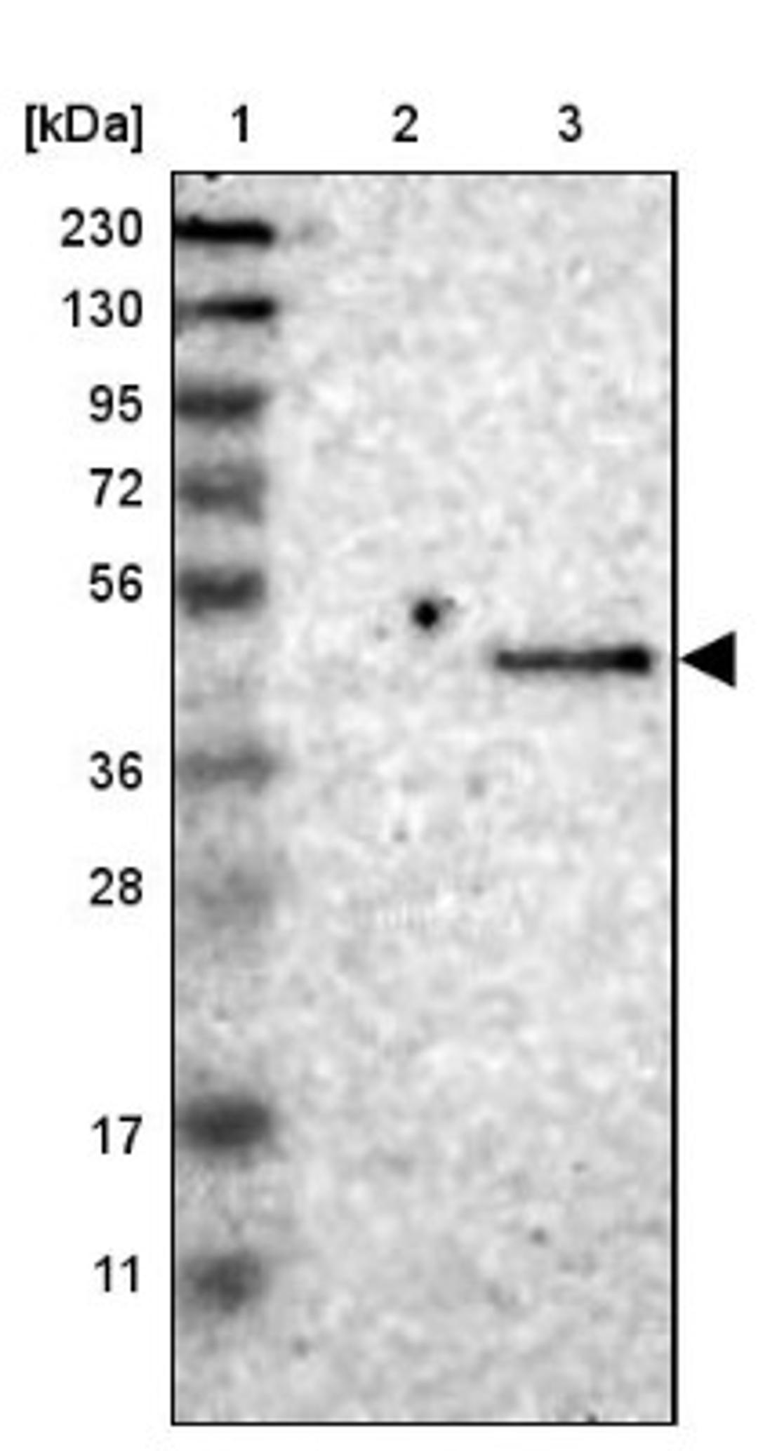 Western Blot: ST3GAL2 Antibody [NBP1-87044] - Lane 1: Marker [kDa] 230, 130, 95, 72, 56, 36, 28, 17, 11<br/>Lane 2: Human cell line RT-4<br/>Lane 3: Human cell line U-251MG sp