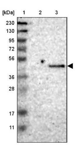 Western Blot: ST3GAL2 Antibody [NBP1-87044] - Lane 1: Marker [kDa] 230, 130, 95, 72, 56, 36, 28, 17, 11<br/>Lane 2: Human cell line RT-4<br/>Lane 3: Human cell line U-251MG sp