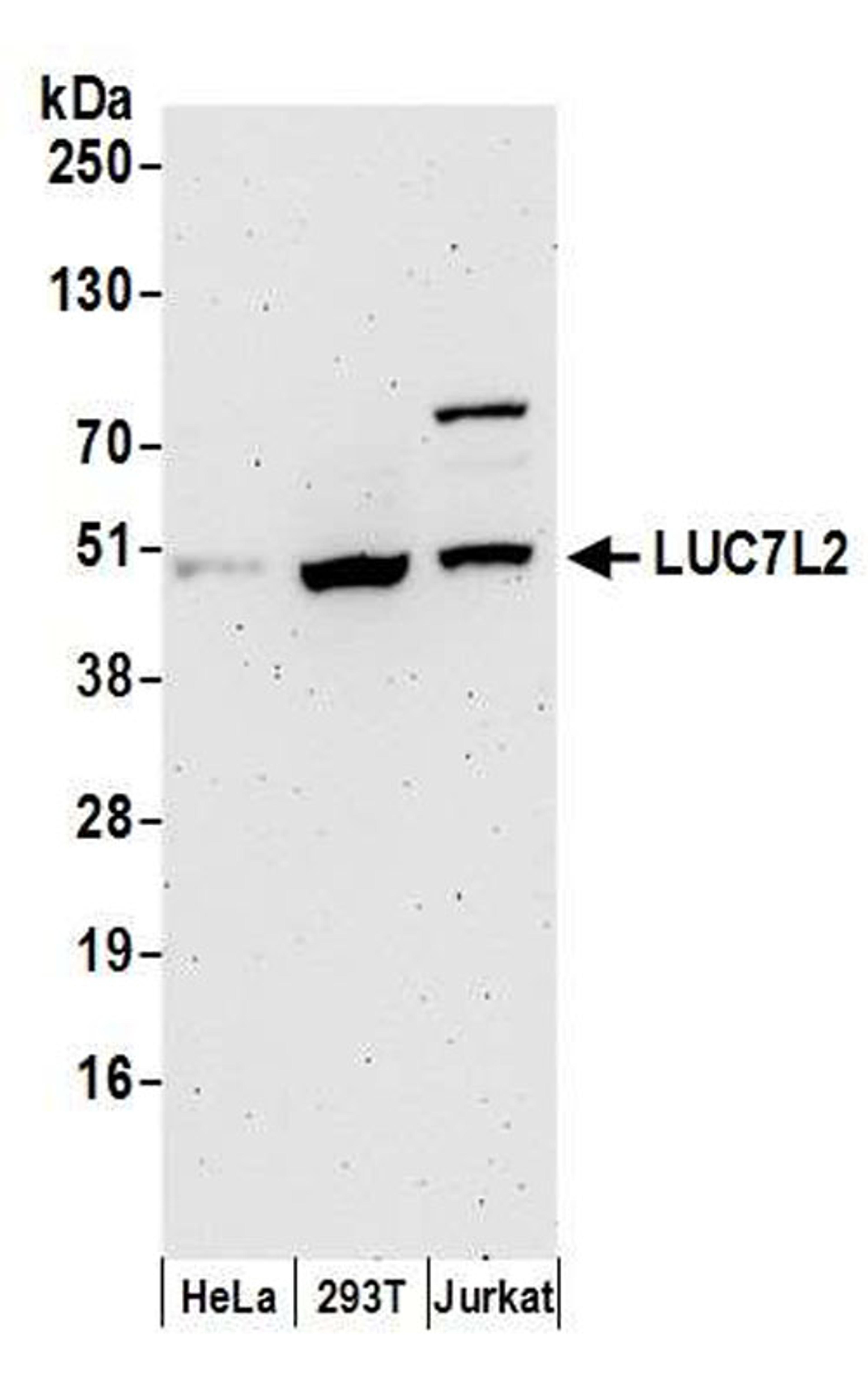 Detection of human LUC7L2 by WB.