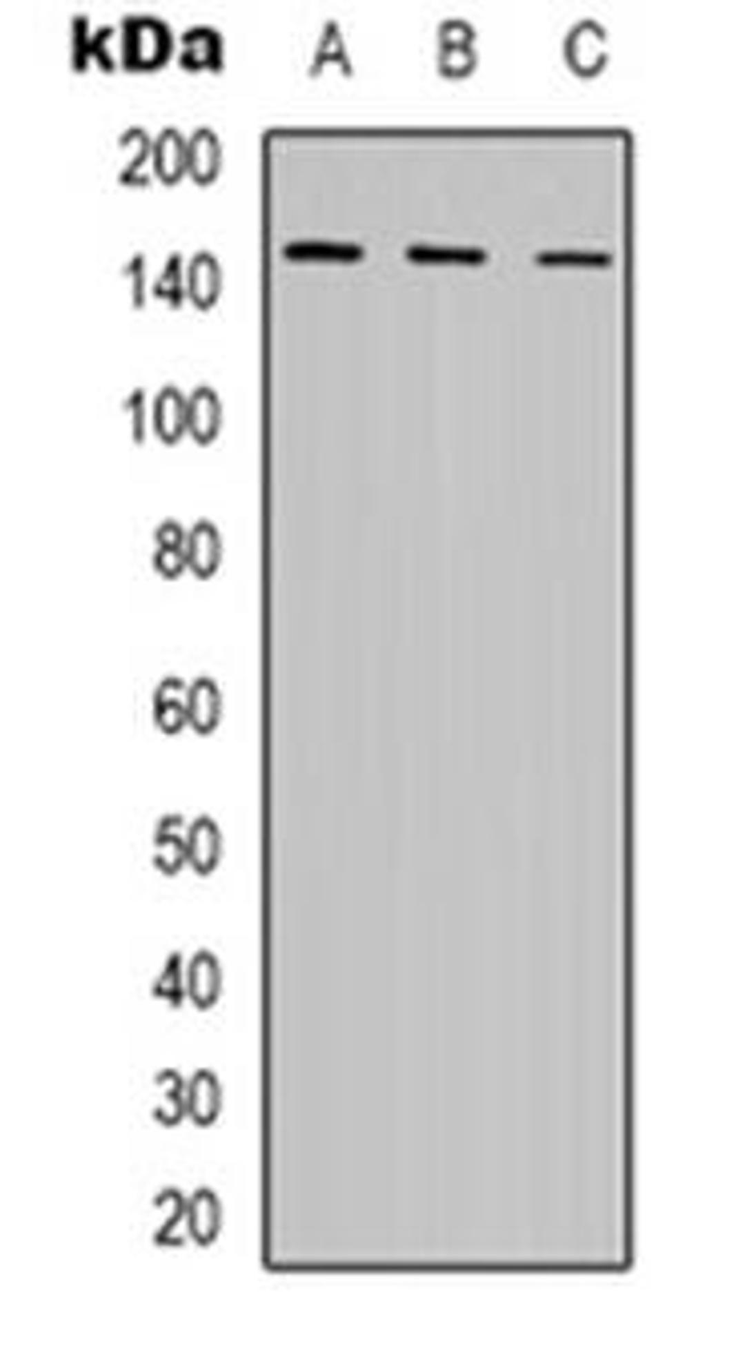 Western blot analysis of POLR3A expression in K562 (Lane 1), MCF7 (Lane 2), COS7 (Lane 3) whole cell lysates using POLR3A antibody