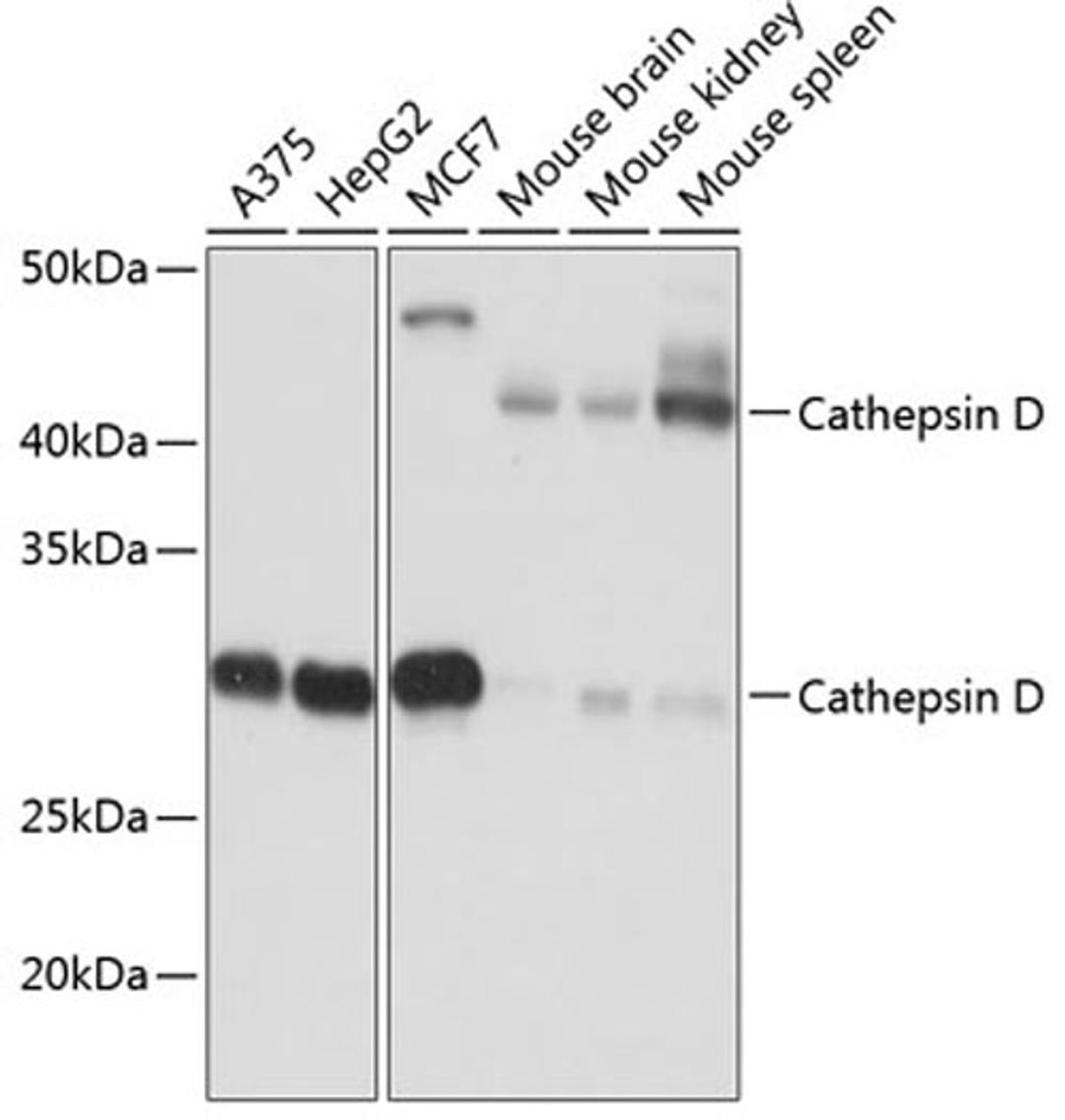 Western blot - Cathepsin D antibody (A19680)