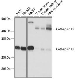 Western blot - Cathepsin D antibody (A19680)