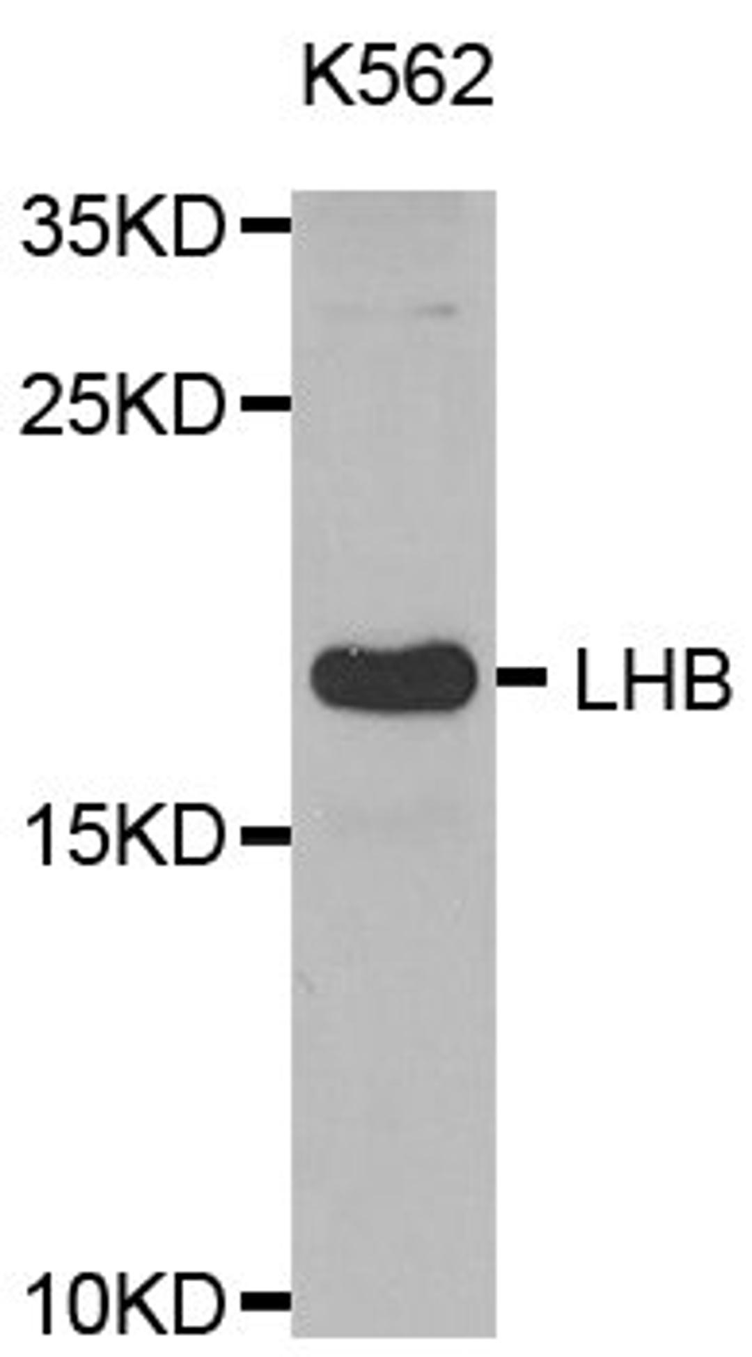 Western blot analysis of extracts of K562 cell line using LHB antibody.