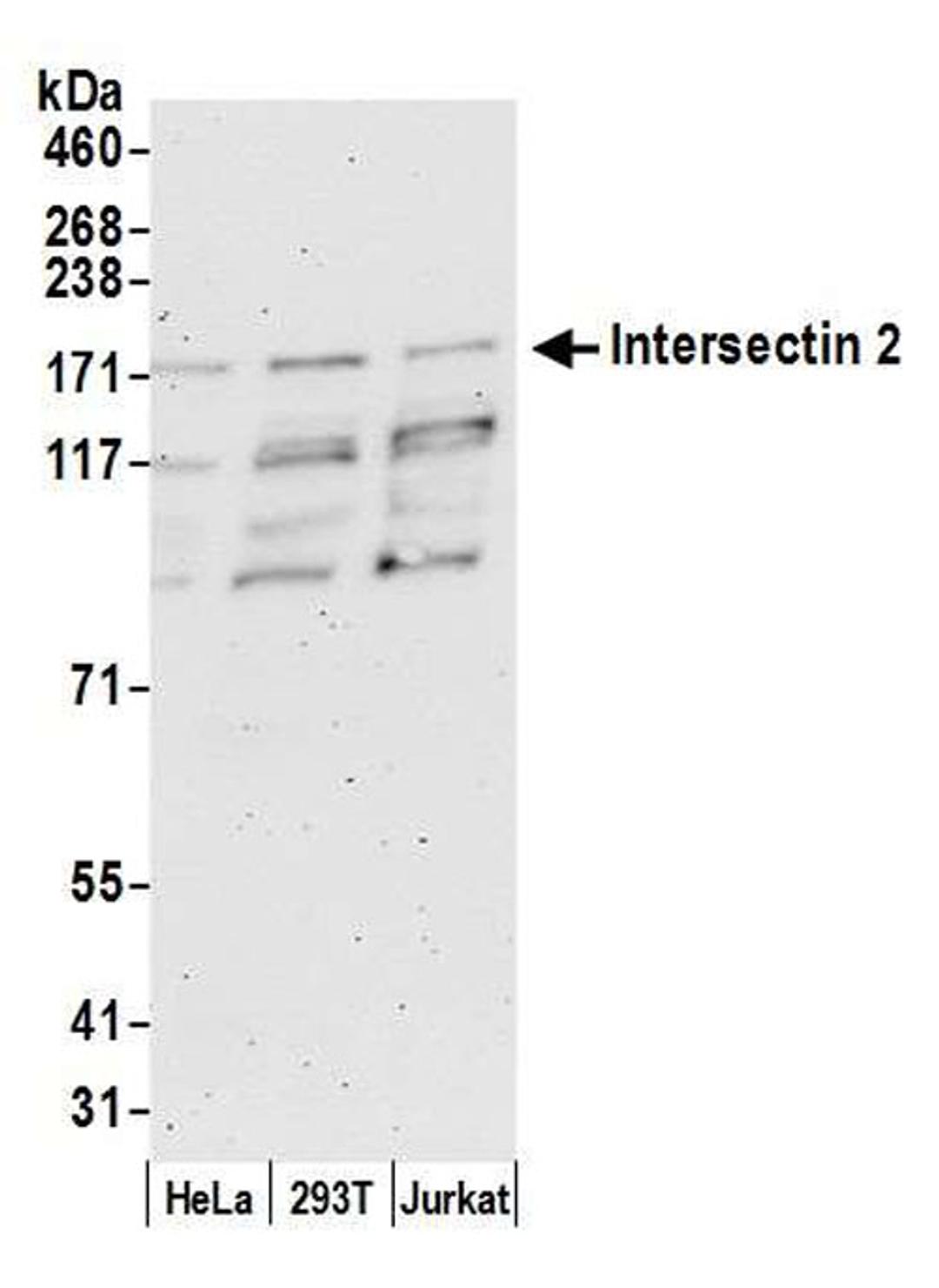 Detection of human Intersectin 2 by WB.