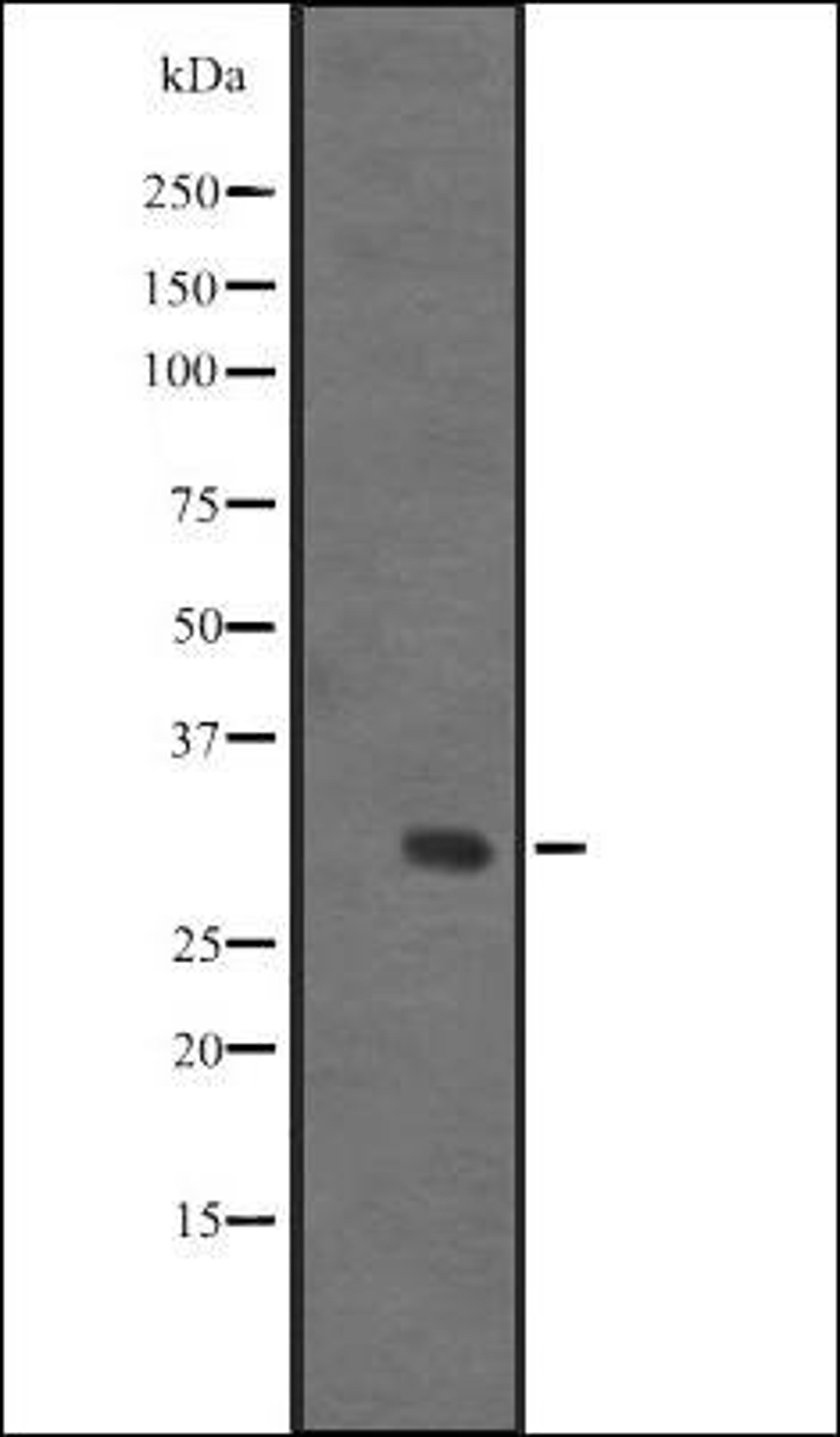 Western blot analysis of Human fetal liver lysate using IGFBPL1 antibody