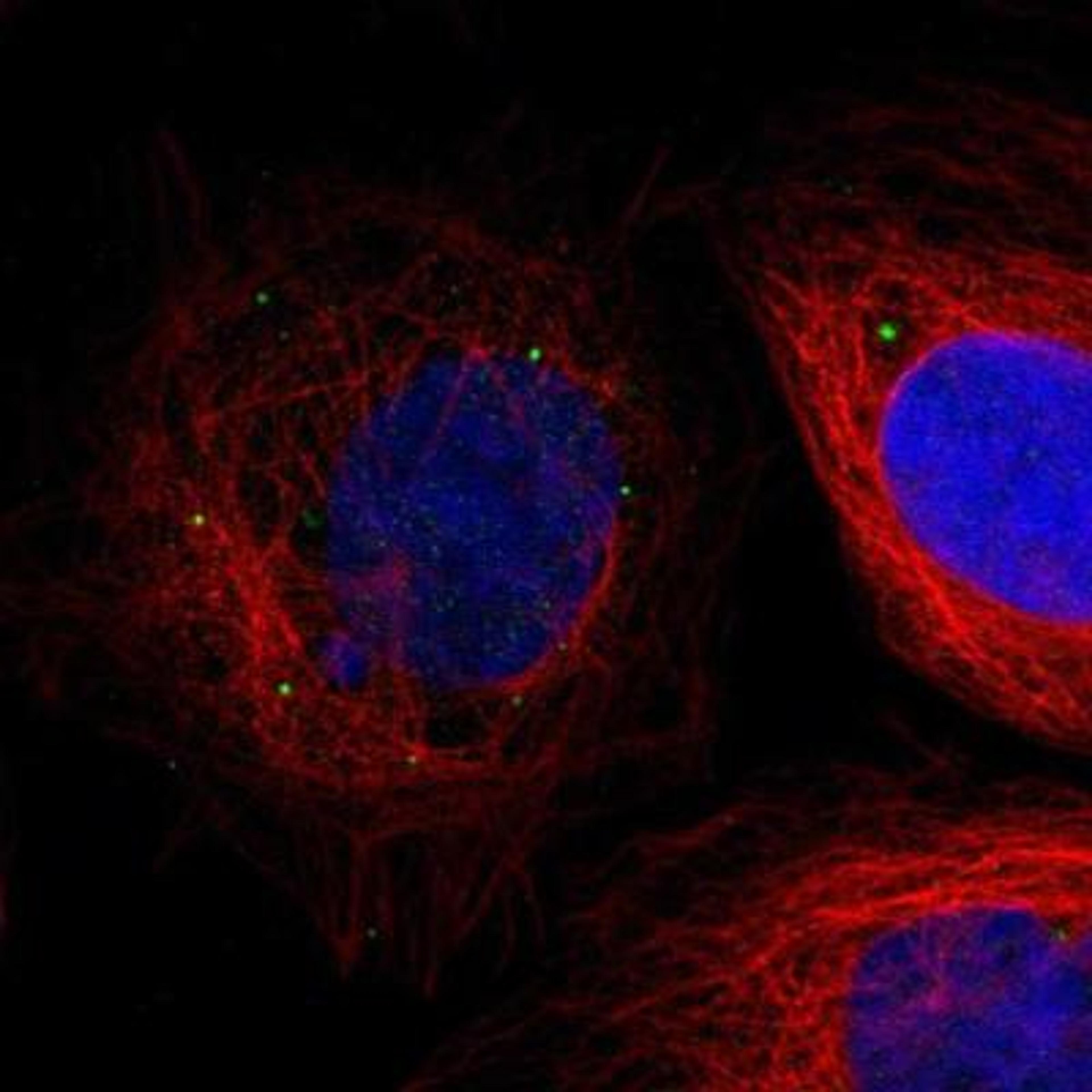 Immunocytochemistry/Immunofluorescence: IL1RL2 Antibody [NBP1-81594] - Staining of human cell line U-2 OS shows positivity in vesicles.