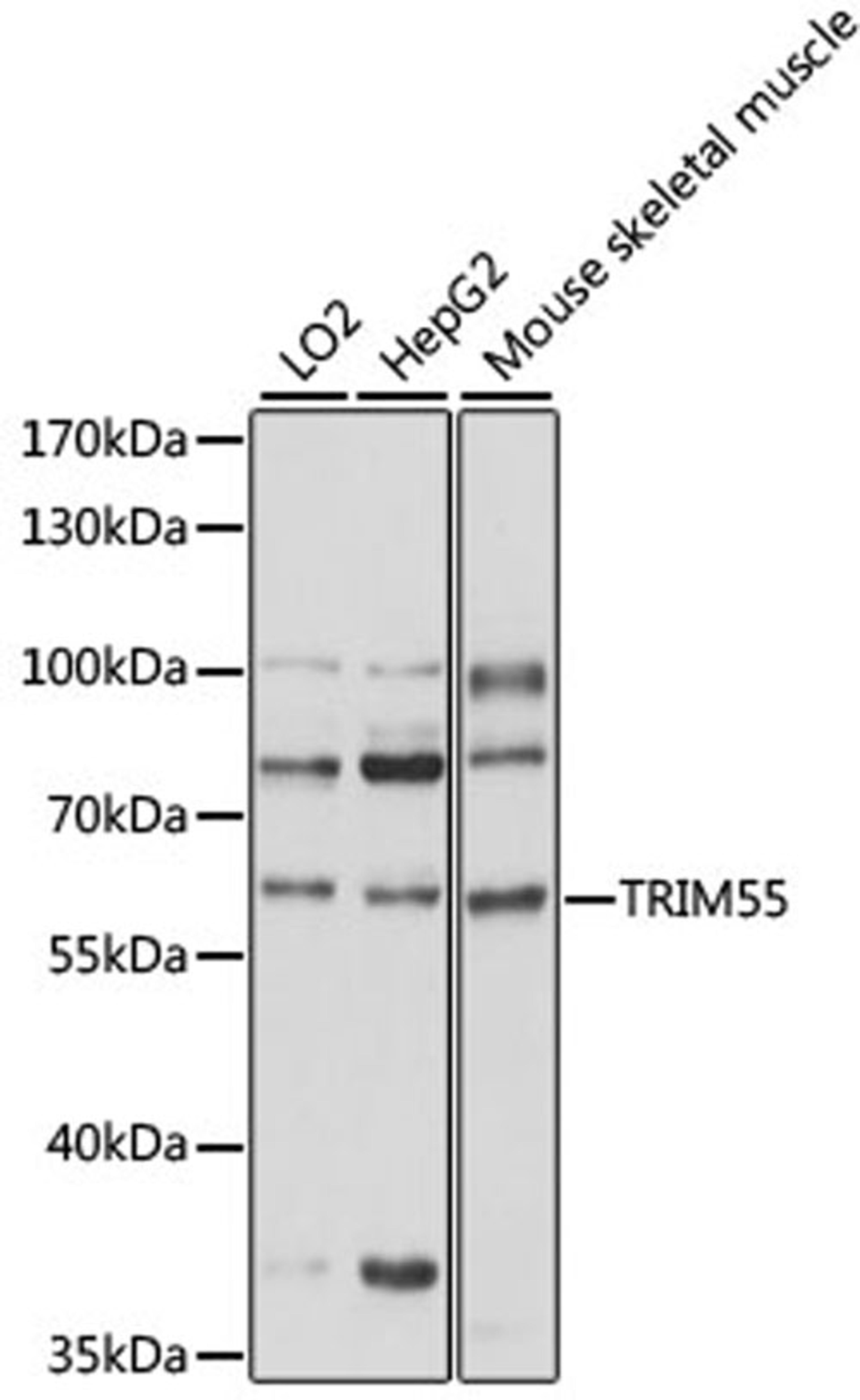 Western blot - TRIM55 antibody (A15917)