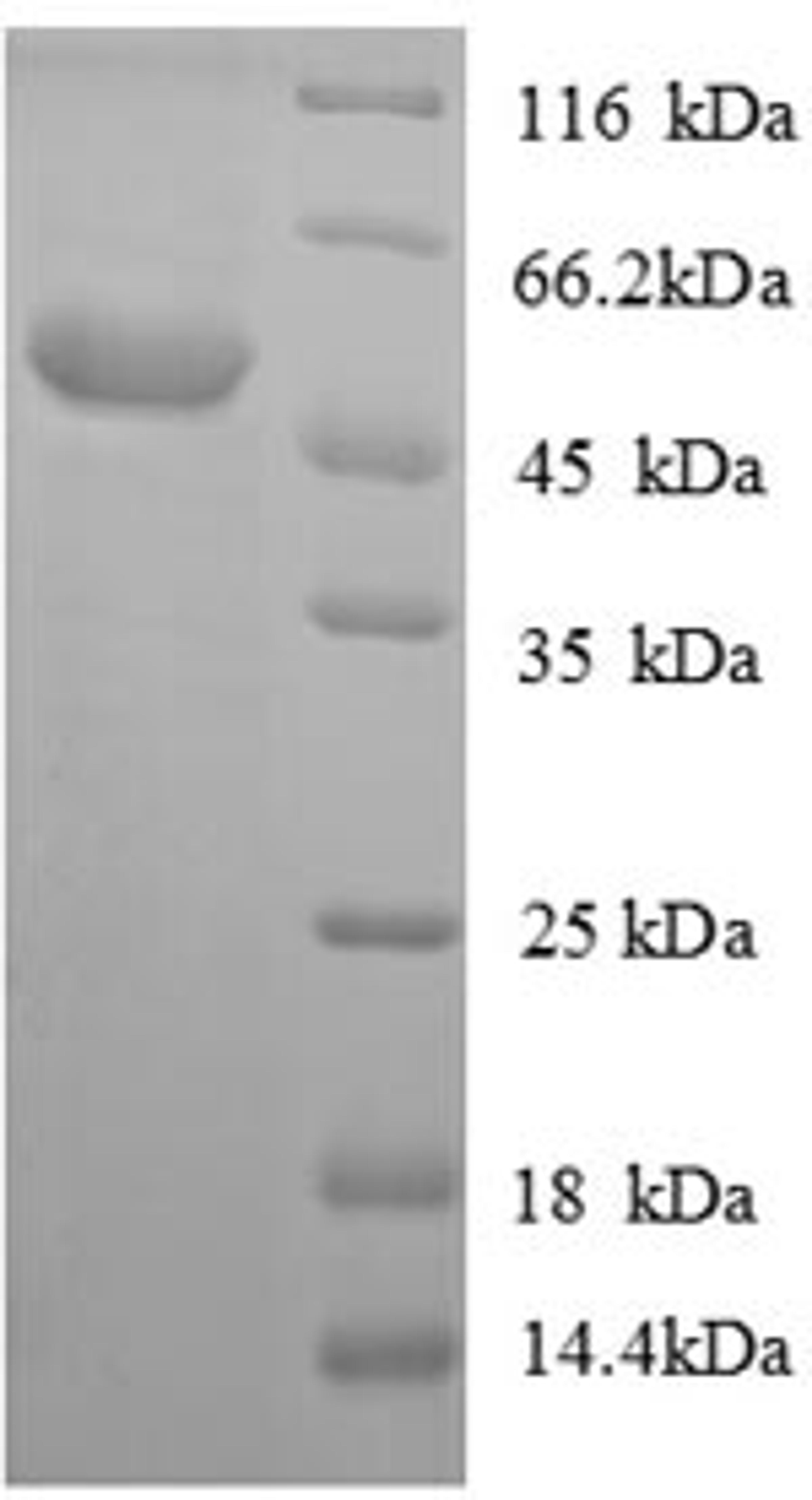 (Tris-Glycine gel) Discontinuous SDS-PAGE (reduced) with 5% enrichment gel and 15% separation gel.