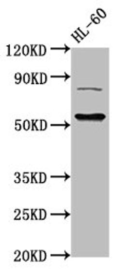 Western Blot. Positive WB detected in: HL60 whole cell lysate. All lanes: KAT5 antibody at 3ug/ml. Secondary. Goat polyclonal to rabbit IgG at 1/50000 dilution. Predicted band size: 59, 54, 62, 57 kDa. Observed band size: 59 kDa. 