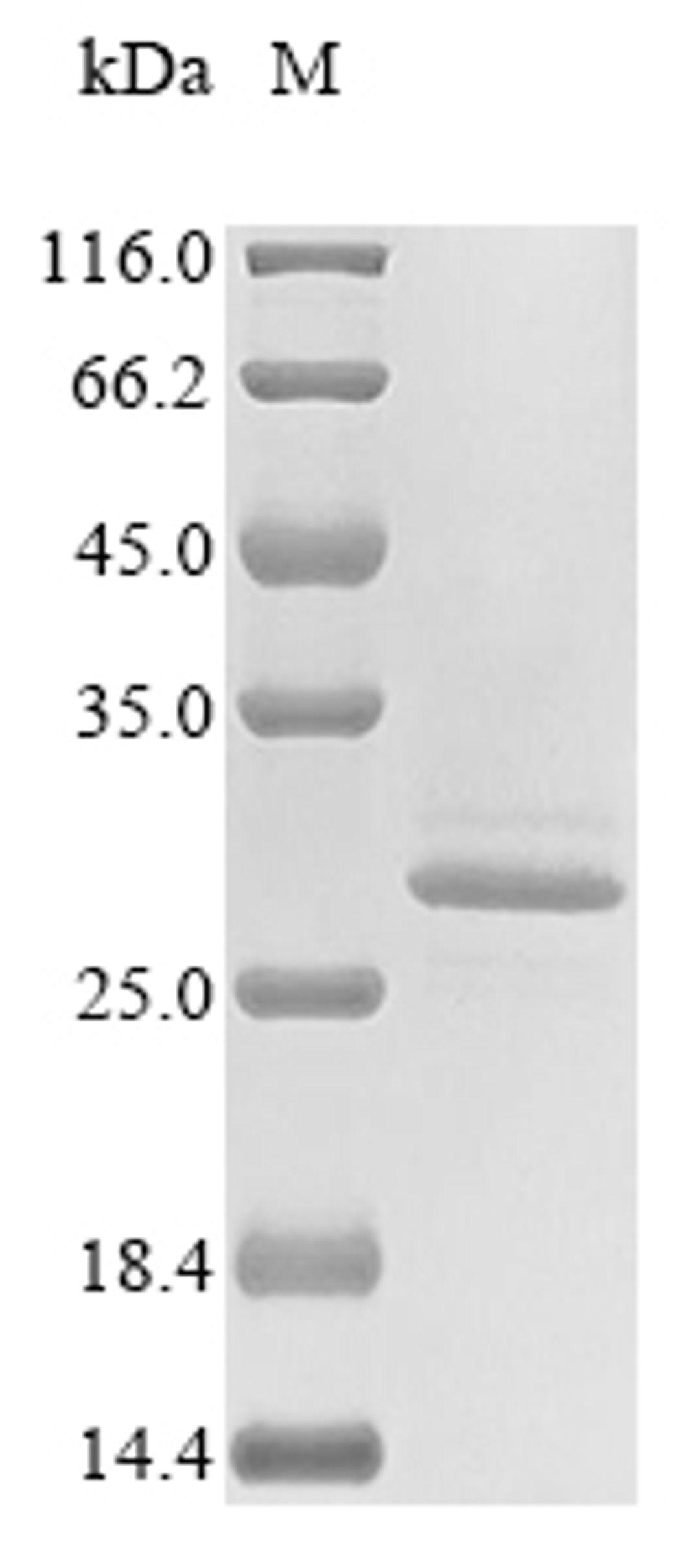 (Tris-Glycine gel) Discontinuous SDS-PAGE (reduced) with 5% enrichment gel and 15% separation gel.
