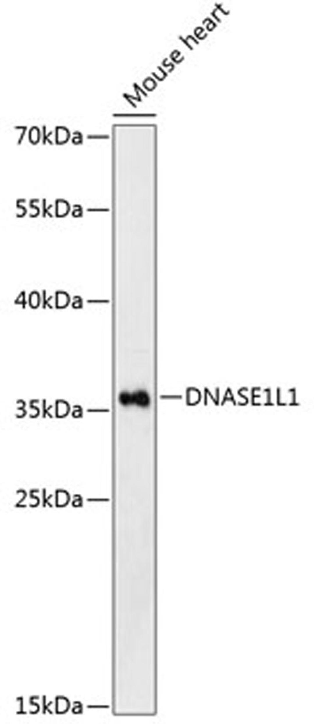 Western blot - DNASE1L1 Antibody (A13150)