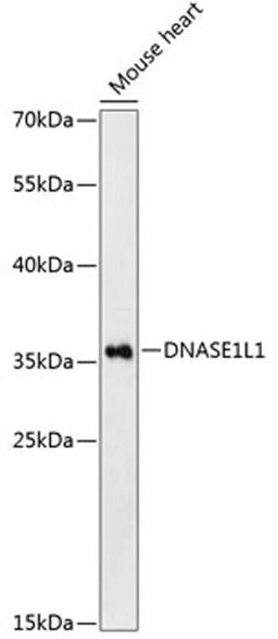 Western blot - DNASE1L1 Antibody (A13150)