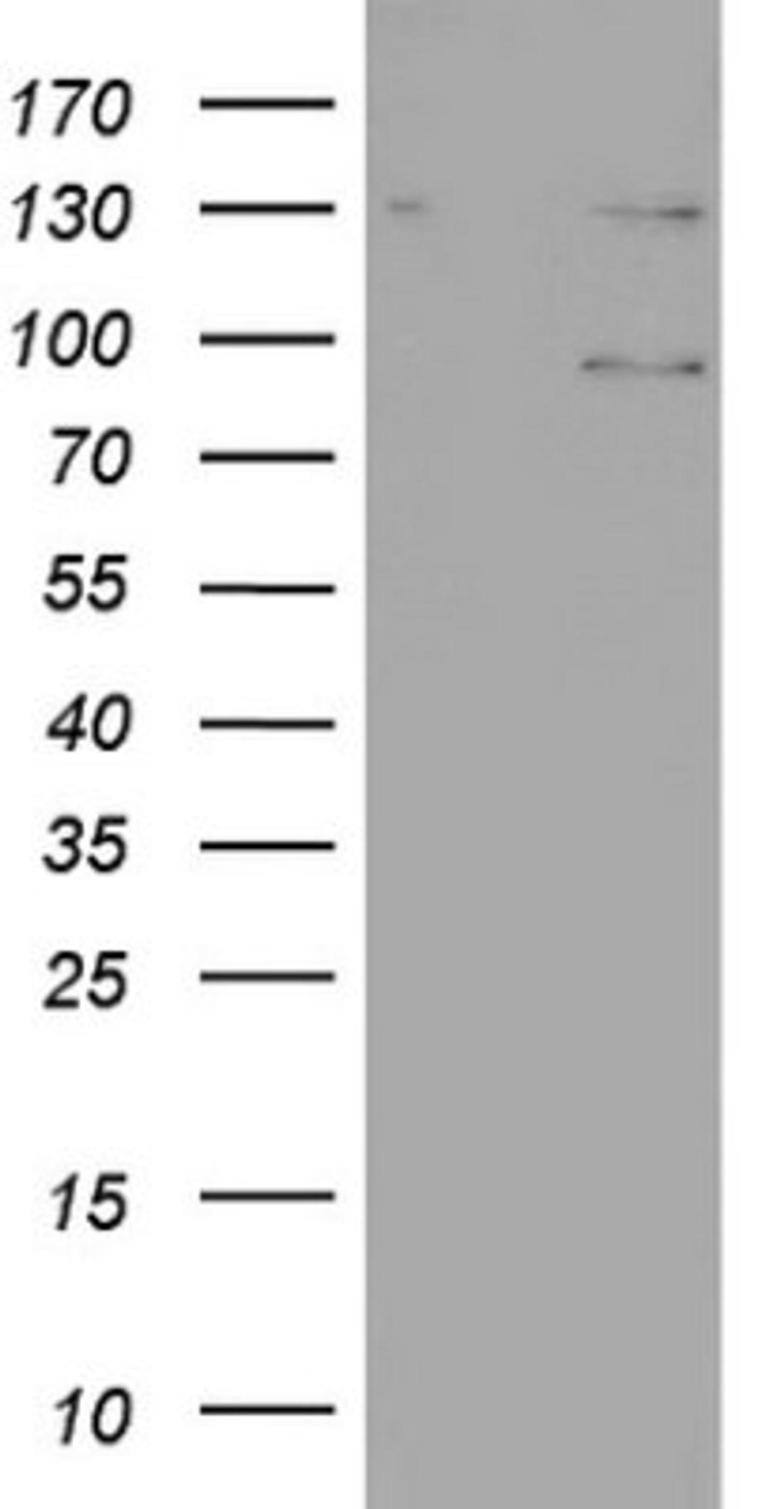 Western Blot: N4BP2L2 Antibody (1C8) [NBP2-46078] - Analysis of HEK293T cells were transfected with the pCMV6-ENTRY control (Left lane) or pCMV6-ENTRY N4BP2L2.