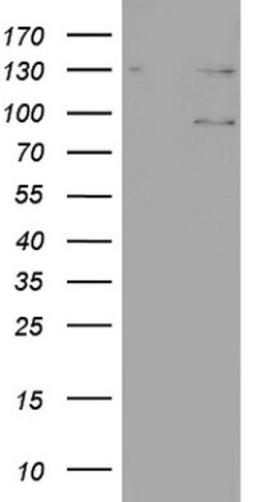 Western Blot: N4BP2L2 Antibody (1C8) [NBP2-46078] - Analysis of HEK293T cells were transfected with the pCMV6-ENTRY control (Left lane) or pCMV6-ENTRY N4BP2L2.