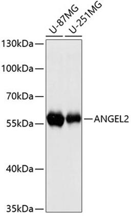 Western blot - ANGEL2 antibody (A12799)