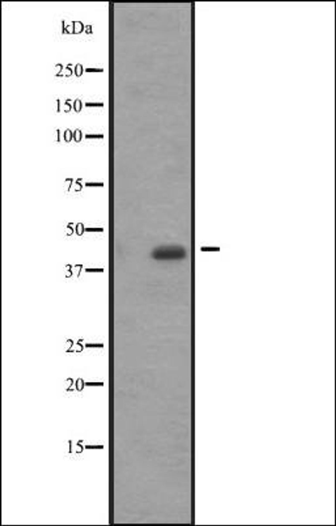 Western blot analysis of A431 whole cell lysate using ACTA1/A2/C1 antibody