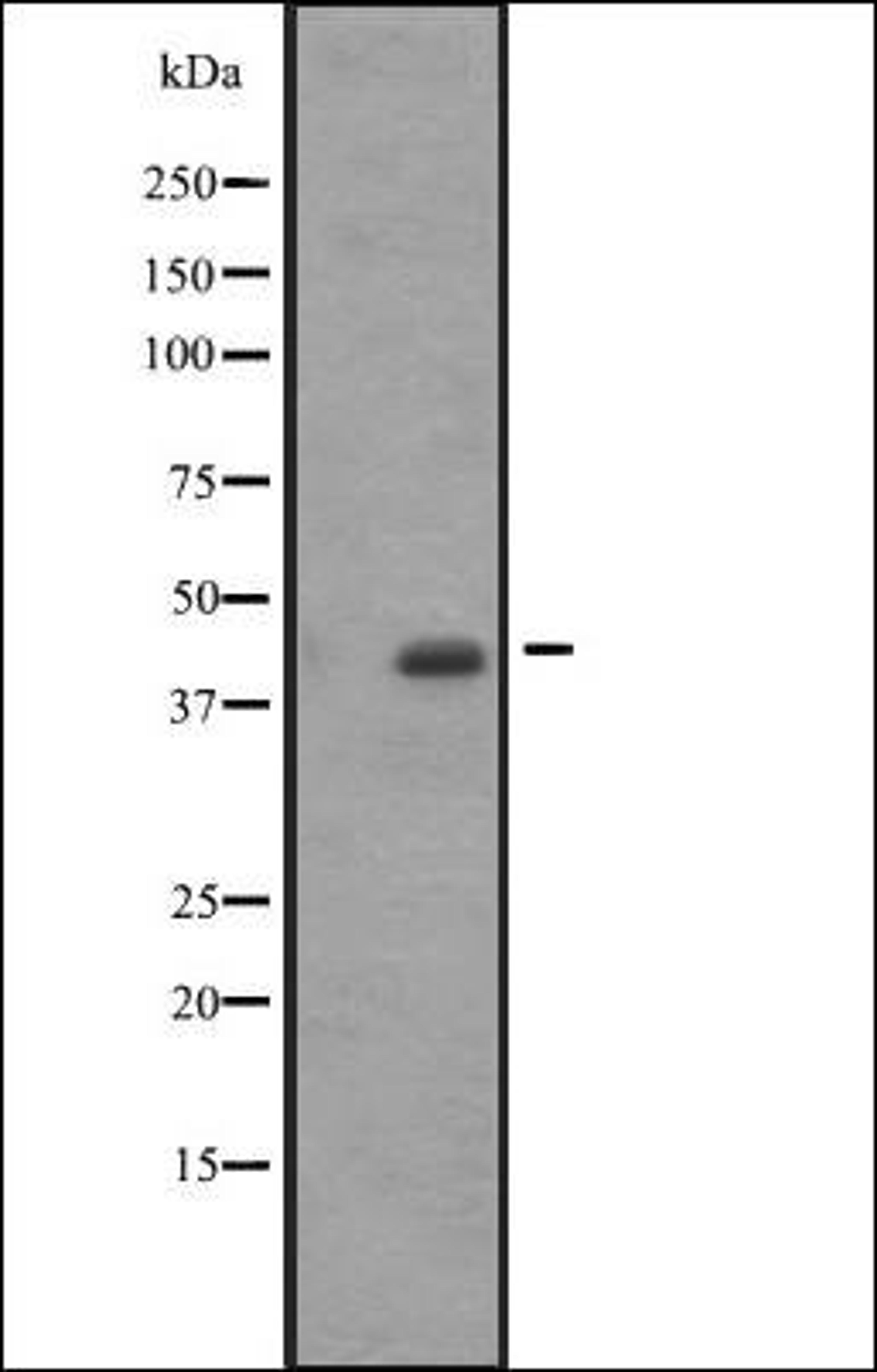 Western blot analysis of A431 whole cell lysate using ACTA1/A2/C1 antibody