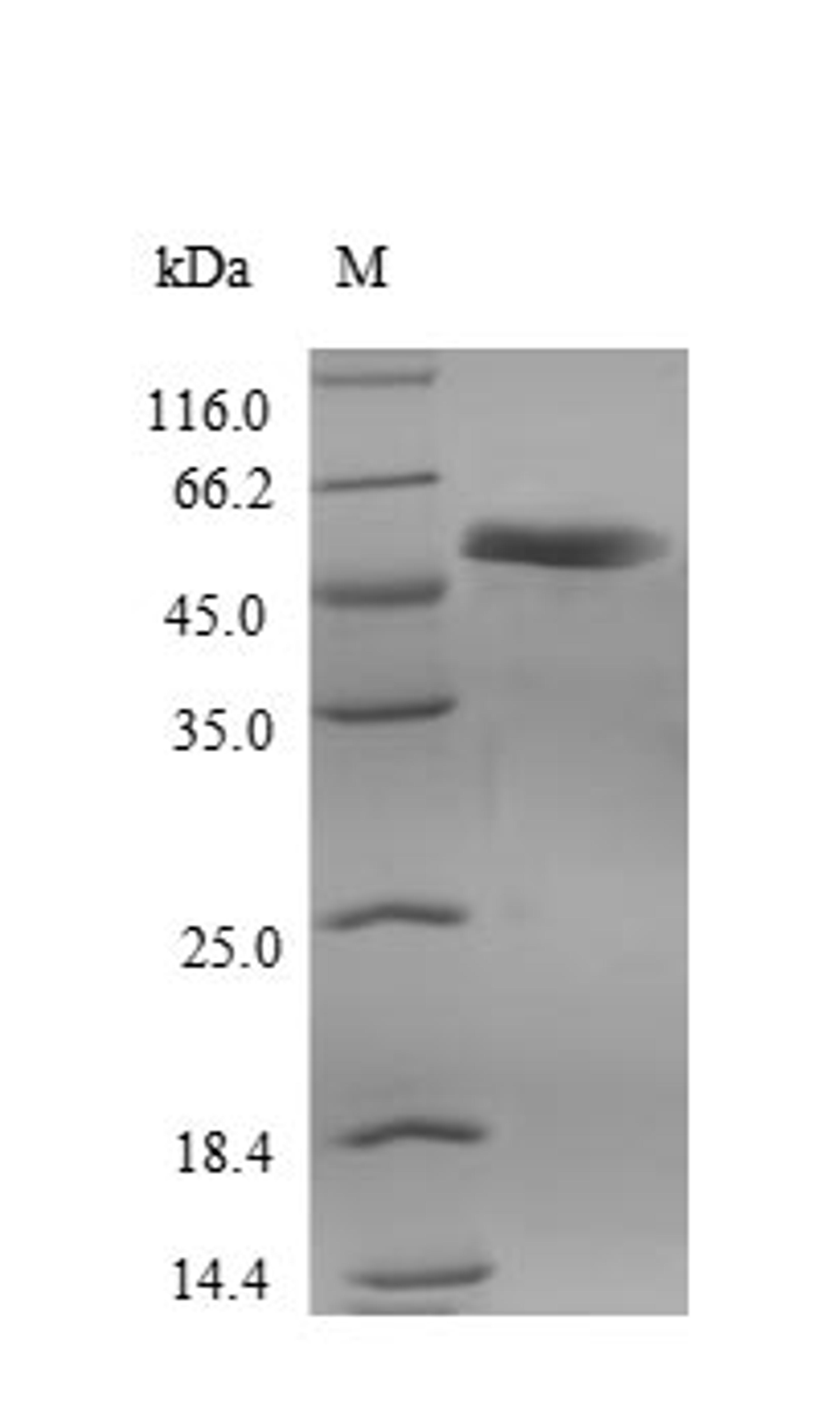 (Tris-Glycine gel) Discontinuous SDS-PAGE (reduced) with 5% enrichment gel and 15% separation gel.