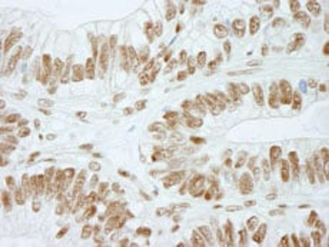 Detection of human RbBP5 by immunohistochemistry.