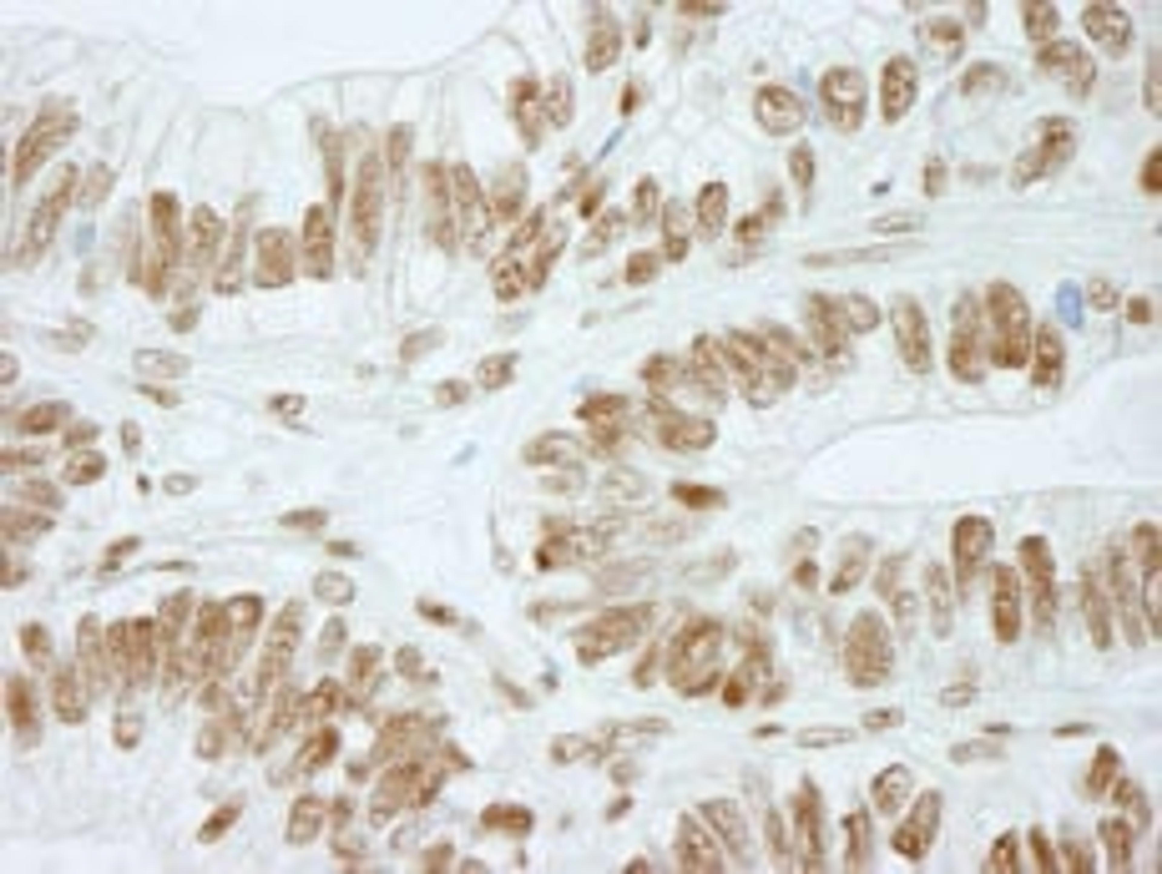 Detection of human RbBP5 by immunohistochemistry.