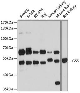 Western blot - GSS antibody (A13495)