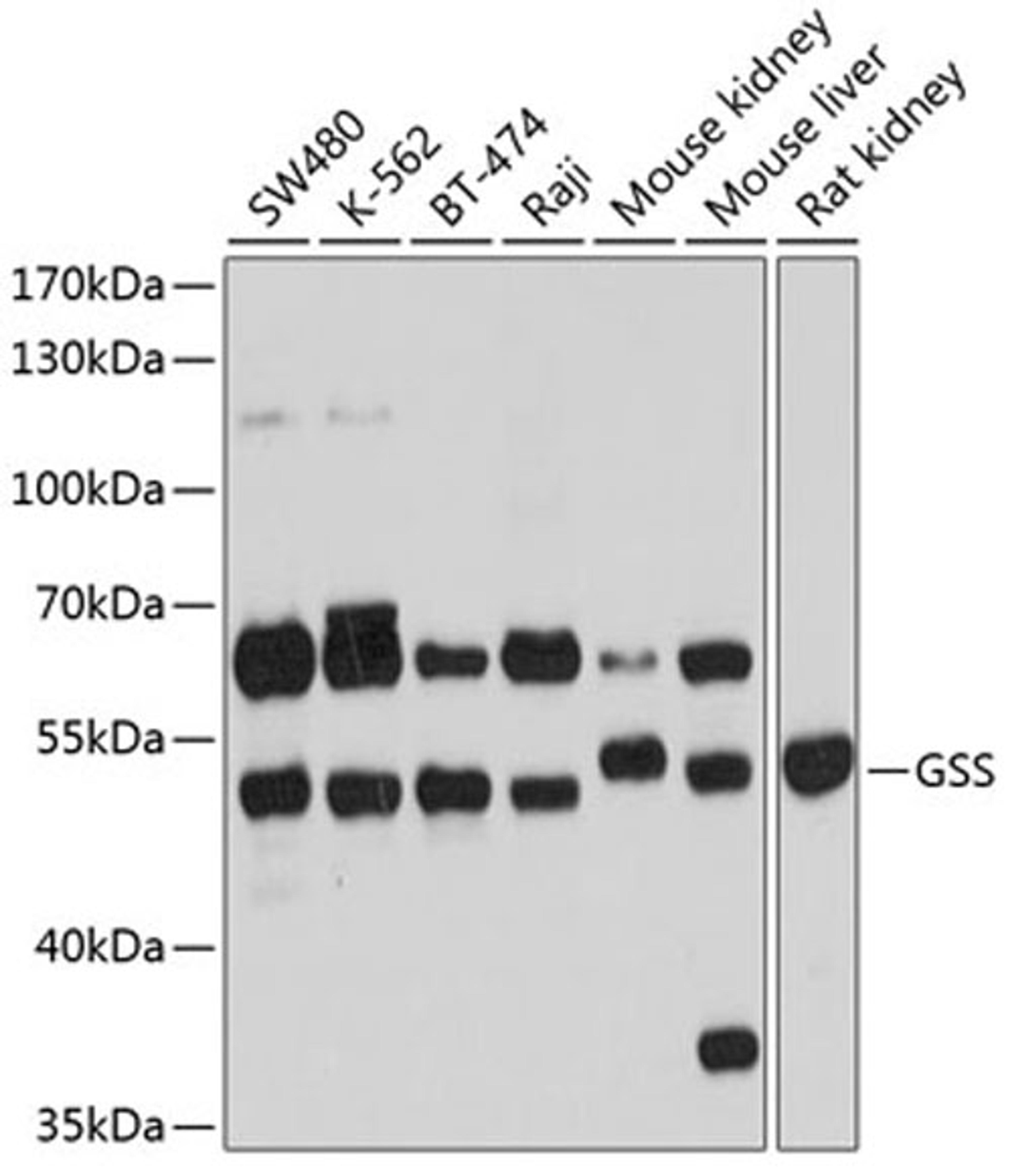 Western blot - GSS antibody (A13495)