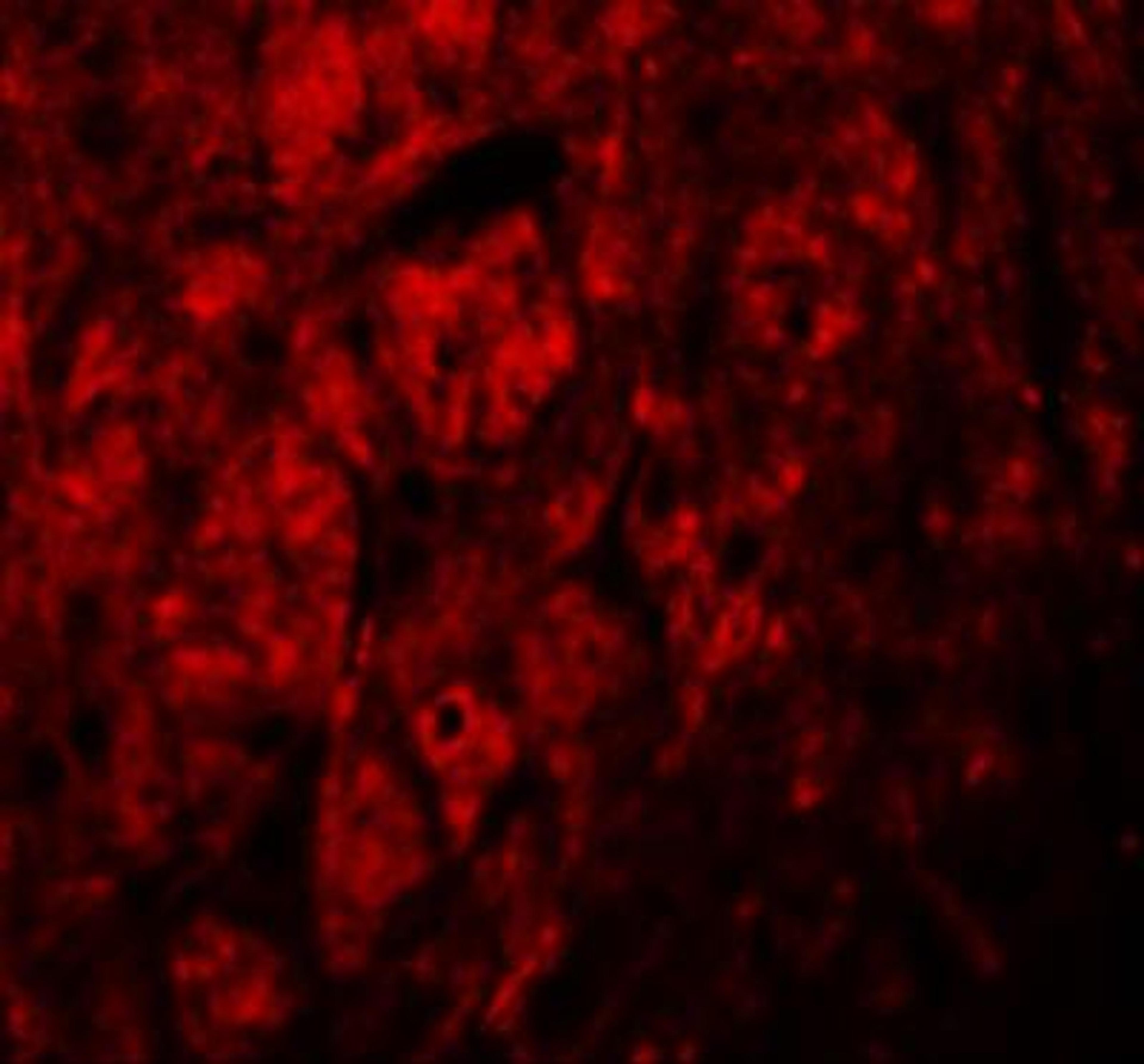 Immunocytochemistry/Immunofluorescence: LRRTM3 Antibody [NBP1-76529] - Immunofluorescence of LRRTM3 in human brain tissue with LRRTM3 antibody at 20 ug/mL.