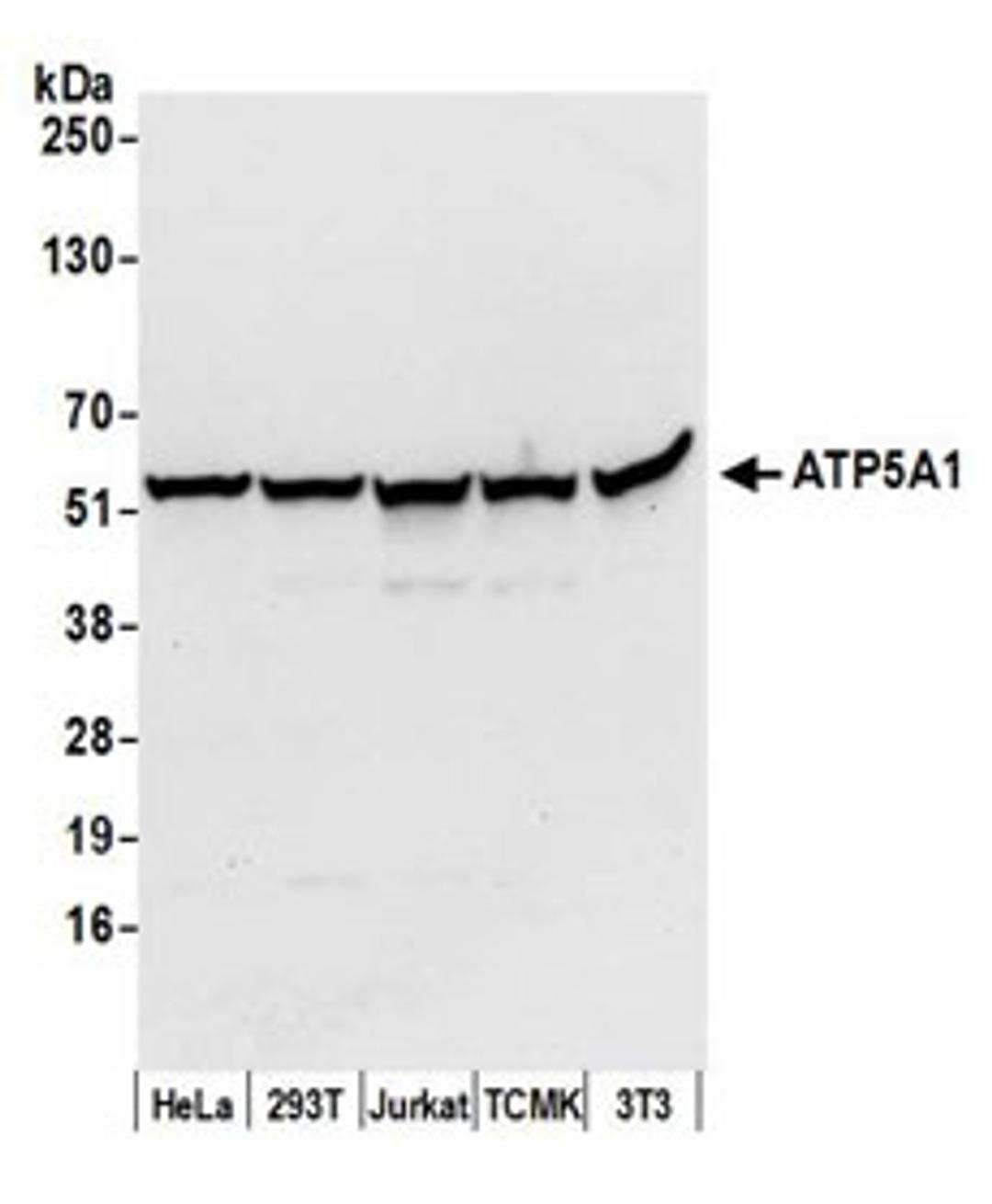 Detection of human and mouse ATP5A1 by western blot.