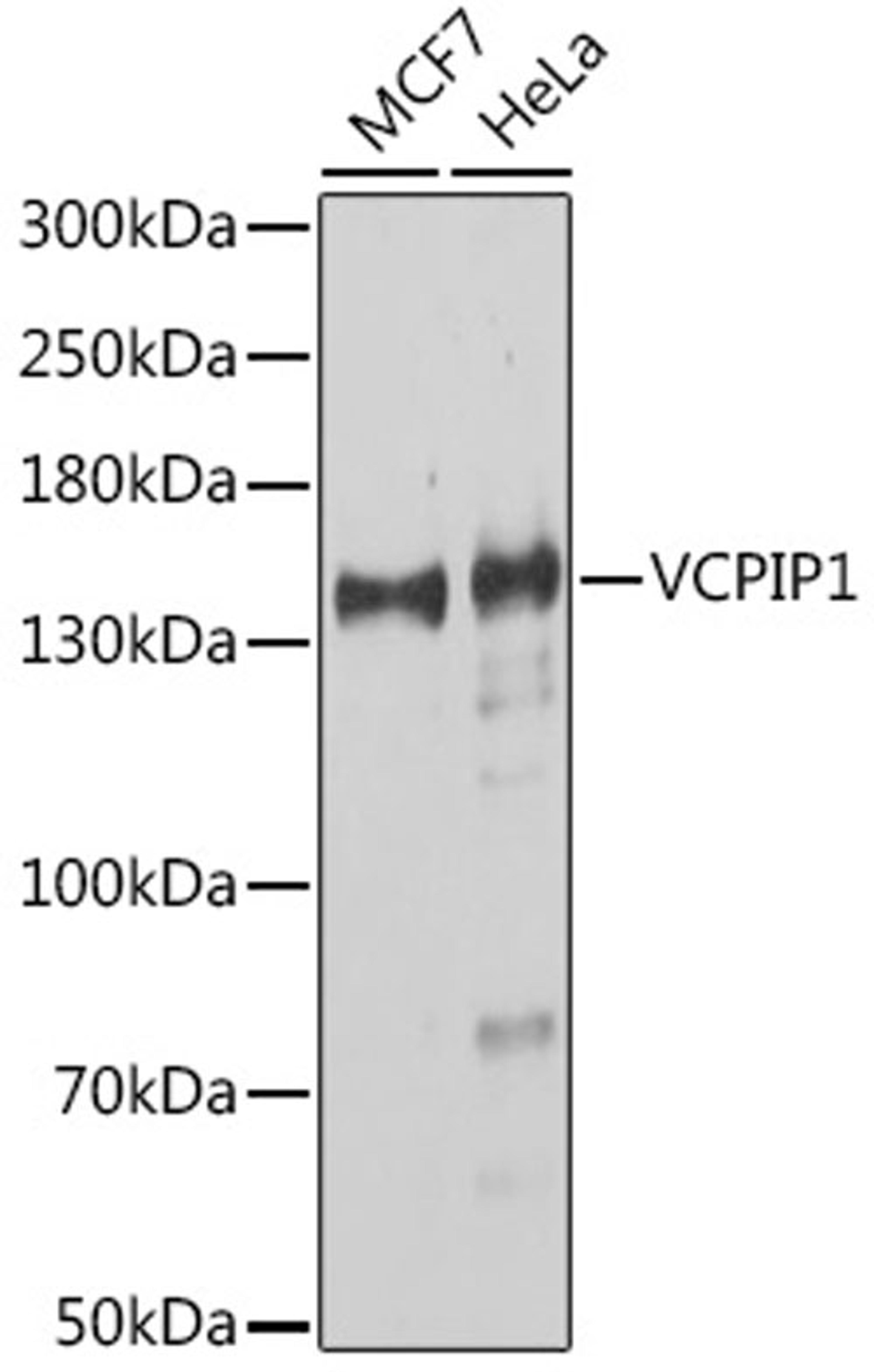 Western blot - VCPIP1 antibody (A16572)