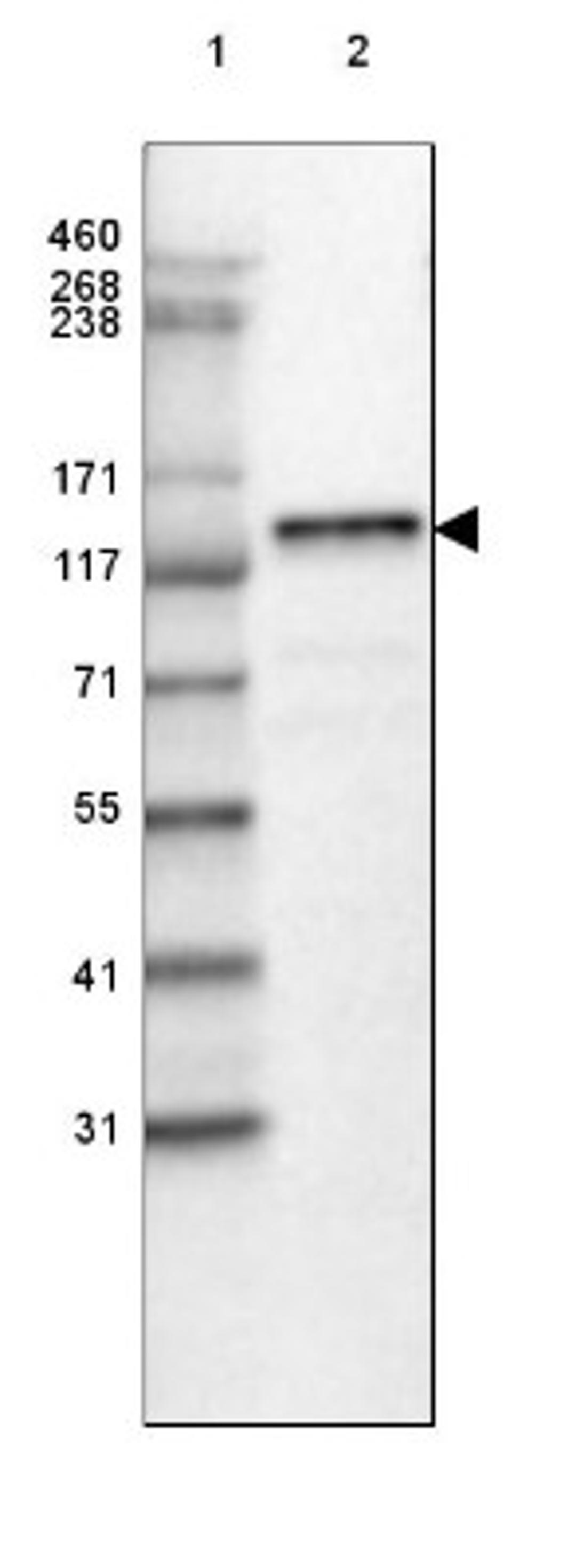 Western Blot: Laminin beta 3 Antibody (3353) [NBP2-46622] - Lane 1: Marker [kDa] 460, 268, 238, 171, 117, 71, 55, 41, 31.  Lane 2: Human Lung tissue