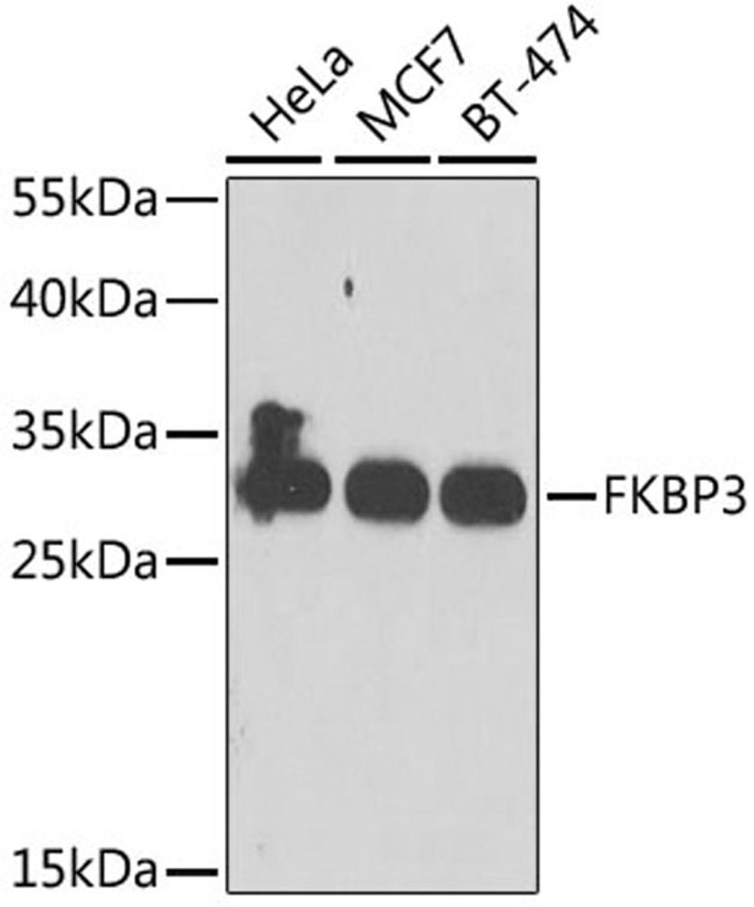 Western blot - FKBP3 antibody (A6907)