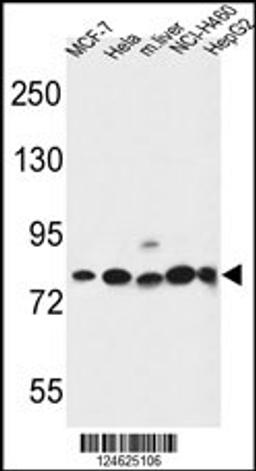 Western blot analysis in MCF-7,Hela,NCI-H460,HepG2 cell line and mouse liver tissue lysates (35ug/lane).