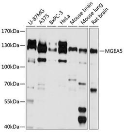 Western blot - MGEA5 antibody (A9033)