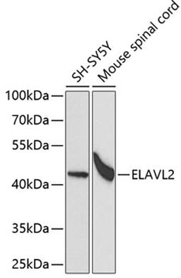 Western blot - ELAVL2 antibody (A5918)