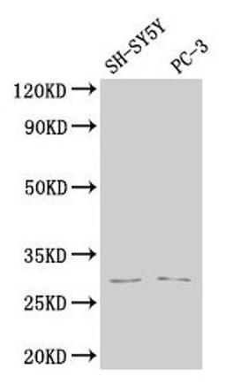Western Blot. Positive WB detected in: SH-SY5Y whole cell lysate, PC-3 whole cell lysate. All lanes: APH1B antibody at 1:2000. Secondary. Goat polyclonal to rabbit IgG at 1/50000 dilution. Predicted band size: 29, 25 kDa. Observed band size: 29 kDa. 