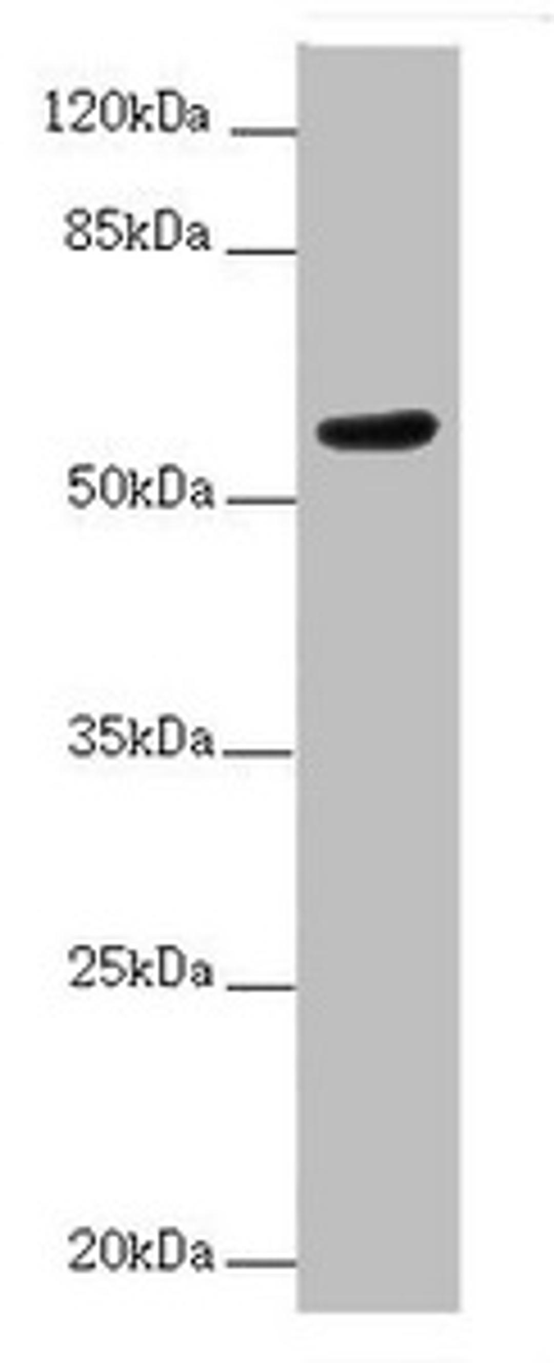 Western blot. All lanes: ACVRL1 antibody at 2ug/ml + MCF-7 whole cell lysate. Secondary. Goat polyclonal to rabbit IgG at 1/10000 dilution. Predicted band size: 57 kDa. Observed band size: 57 kDa.