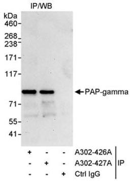 Detection of human PAP-gamma by western blot of immunoprecipitates.