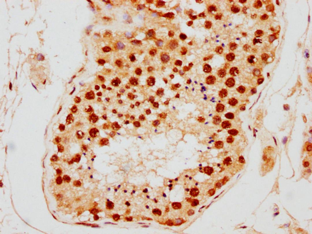 IHC image of CSB-PA010389PA09nsucHU diluted at 1:10 and staining in paraffin-embedded human testis tissue performed on a Leica BondTM system. After dewaxing and hydration, antigen retrieval was mediated by high pressure in a citrate buffer (pH 6.0). Section was blocked with 10% normal goat serum 30min at RT. Then primary antibody (1% BSA) was incubated at 4°C overnight. The primary is detected by a biotinylated secondary antibody and visualized using an HRP conjugated SP system.