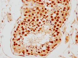 IHC image of CSB-PA010389PA09nsucHU diluted at 1:10 and staining in paraffin-embedded human testis tissue performed on a Leica BondTM system. After dewaxing and hydration, antigen retrieval was mediated by high pressure in a citrate buffer (pH 6.0). Section was blocked with 10% normal goat serum 30min at RT. Then primary antibody (1% BSA) was incubated at 4°C overnight. The primary is detected by a biotinylated secondary antibody and visualized using an HRP conjugated SP system.