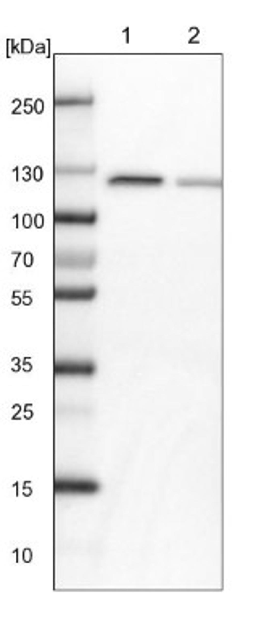 Western Blot: PEX6 Antibody [NBP1-80955] - Lane 1: NIH-3T3 cell lysate (Mouse embryonic fibroblast cells)<br/>Lane 2: NBT-II cell lysate (Rat Wistar bladder tumour cells)