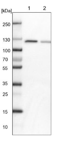 Western Blot: PEX6 Antibody [NBP1-80955] - Lane 1: NIH-3T3 cell lysate (Mouse embryonic fibroblast cells)<br/>Lane 2: NBT-II cell lysate (Rat Wistar bladder tumour cells)