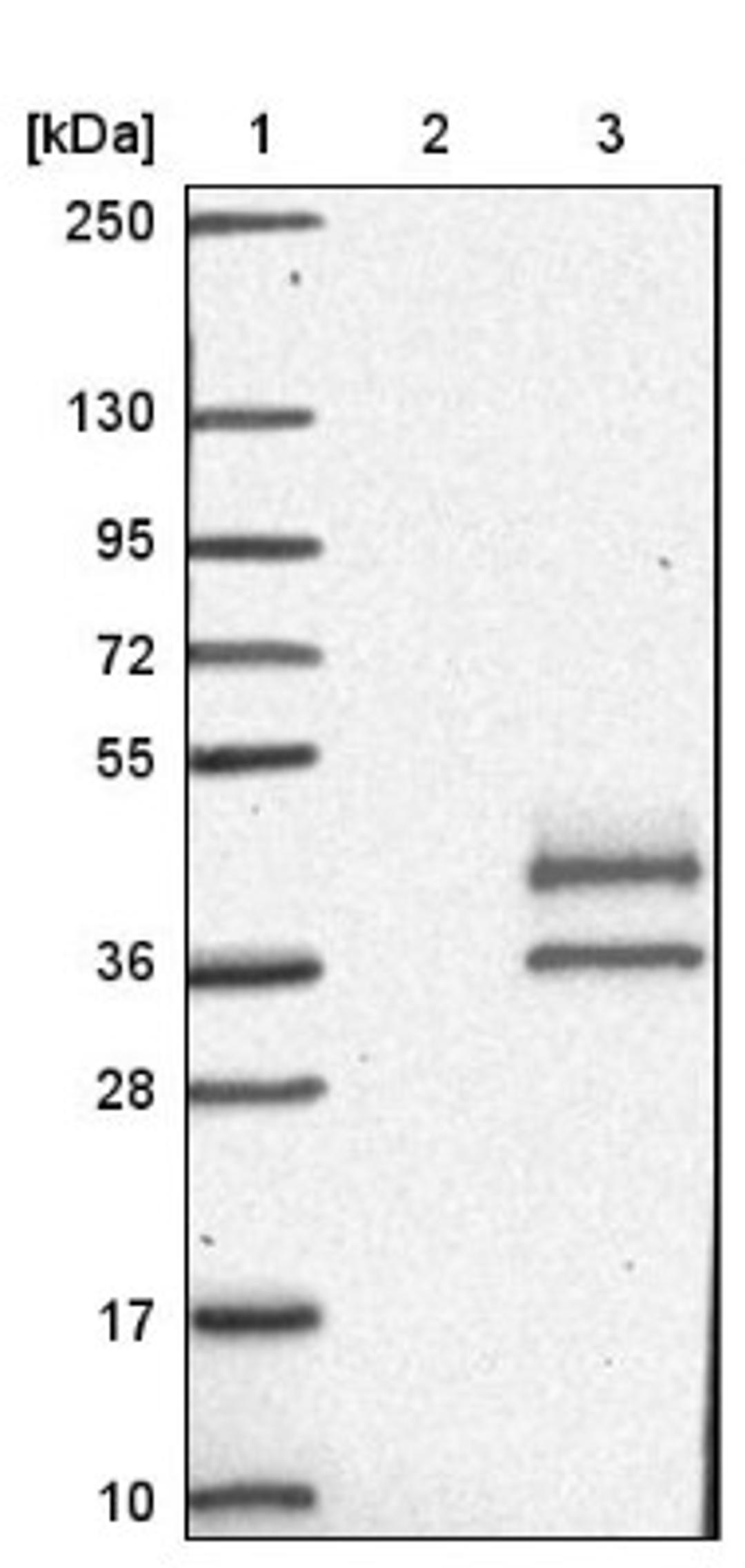 Western Blot: ABHD14A Antibody [NBP1-84147] - Lane 1: Marker [kDa] 250, 130, 95, 72, 55, 36, 28, 17, 10<br/>Lane 2: Negative control (vector only transfected HEK293T lysate)<br/>Lane 3: Over-expression lysate (Co-expressed with a C-terminal myc-DDK tag (~3.1 kDa) in mammalian HEK293T cells, LY414572)