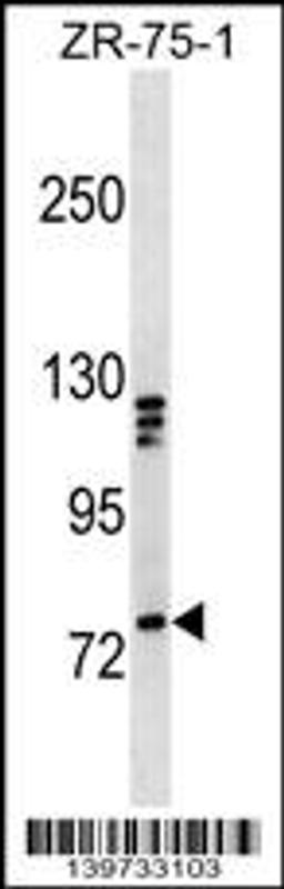 Western blot analysis in ZR-75-1 cell line lysates (35ug/lane).